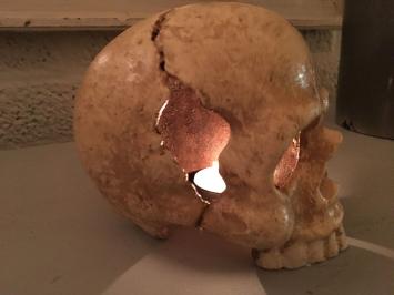 Anatomische schedel, uit gietijzer-white-rust